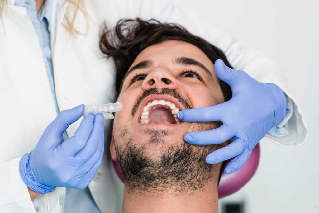 Los hombres prefieren la ortodoncia invisible